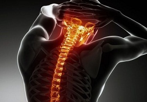 a nyaki gerinc osteochondrosisának kezelésére vonatkozó szabályok