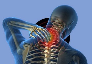 a nyaki osteochondrosis okai
