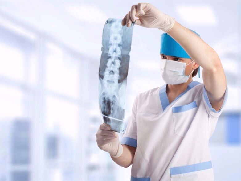 az orvos pillanatfelvételt néz az osteochondrosisos nyaki gerincről