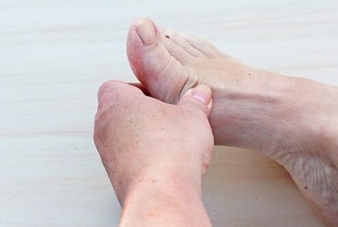 a láb arthrosisa