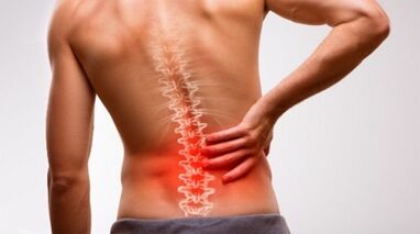 Az ágyéki gerinc osteokondrózisának jelei és tünetei